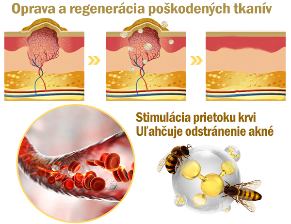 Len 5 fliaš! Využite exkluzívnu zľavu 30% teraz! Udržujte svoju pleť mladistvú a žiarivú už za 1 - 4 týždne. Nezmeškajte to - táto ponuka sa vráti až budúci rok. Konajte rýchlo! 180-dňová záruka vrátenia peňazí!！