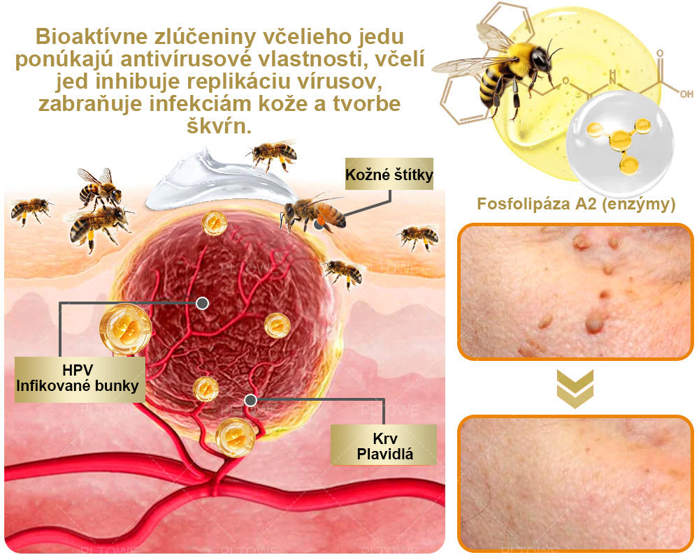 Len 5 fliaš! Využite exkluzívnu zľavu 30% teraz! Udržujte svoju pleť mladistvú a žiarivú už za 1 - 4 týždne. Nezmeškajte to - táto ponuka sa vráti až budúci rok. Konajte rýchlo! 180-dňová záruka vrátenia peňazí!！